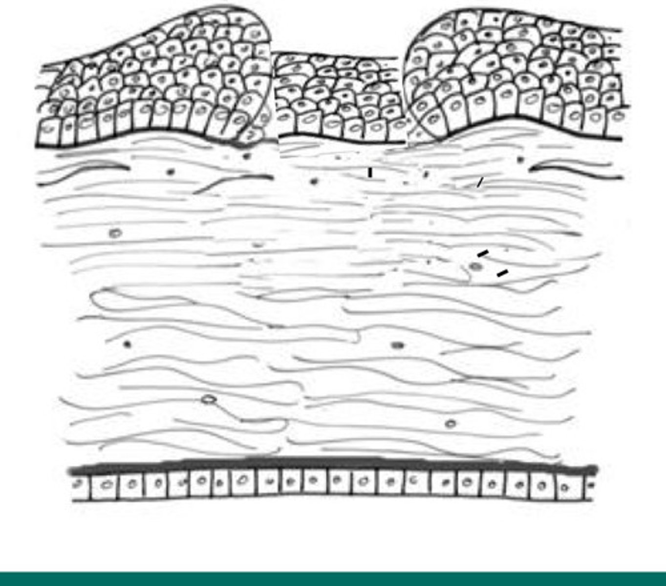 <p>Describe what type of cornea insult is happening here?</p>