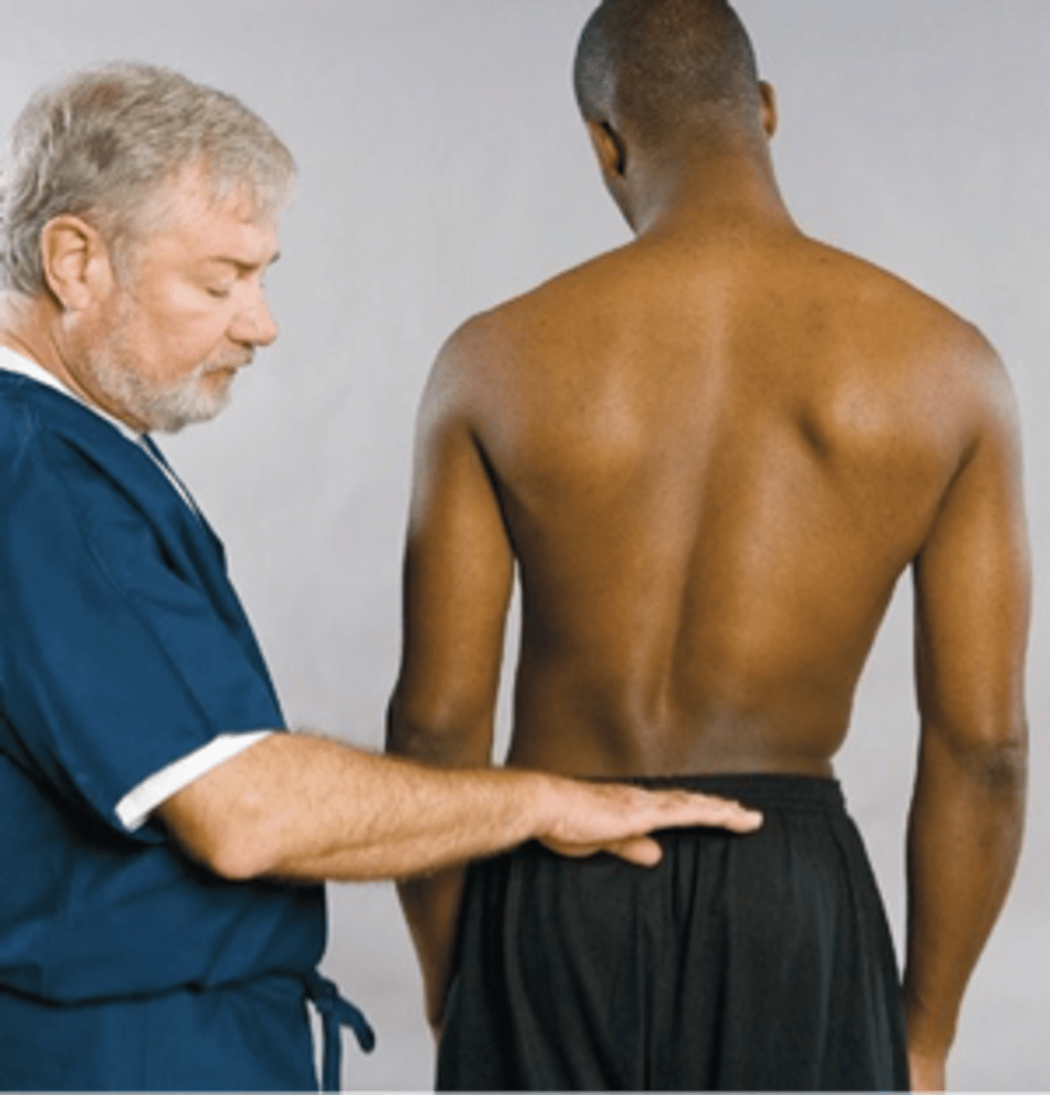 <p>Vanzetti Sign indication:</p><p>- Iliac crest even with antalgia = sciatic due to _____</p>