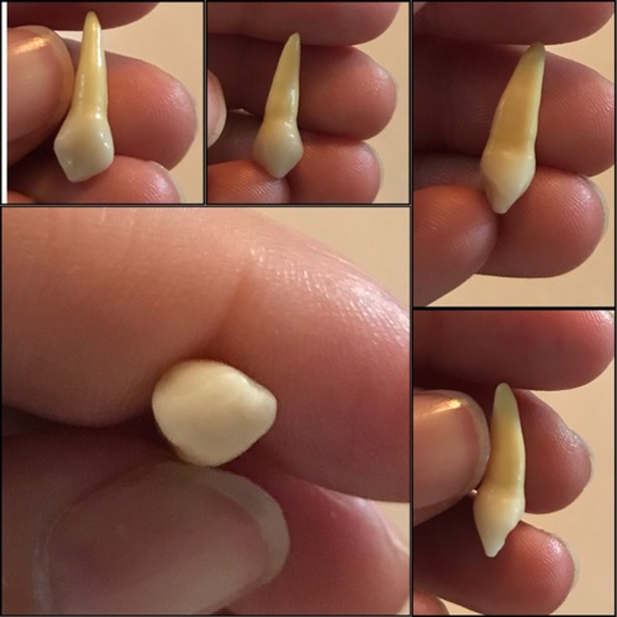 <p>What tooth is this ?</p>