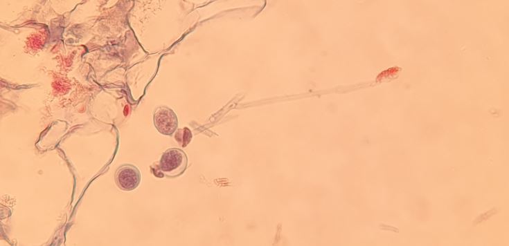 <p>Potatismögel, Tvärsnitt genom blad; ur klyvöppningarna växer sporangioforer med sporangier (Oomycota)</p>