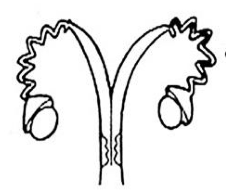 <p>Which uterine classification is this?</p>