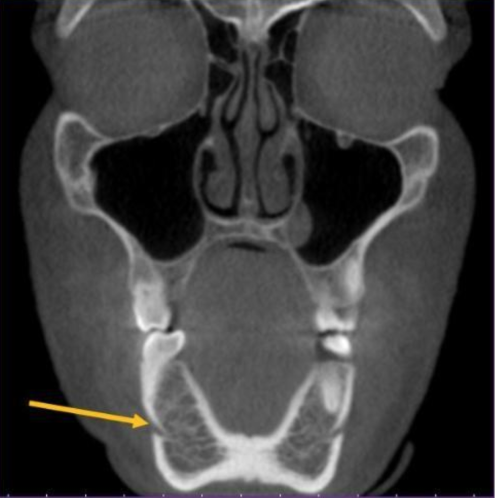 <p>what is the structure indicated by the arrow </p>