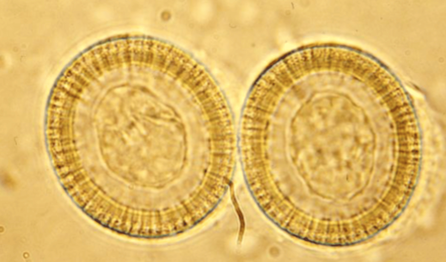 <p>embryo (oncosphere)</p>