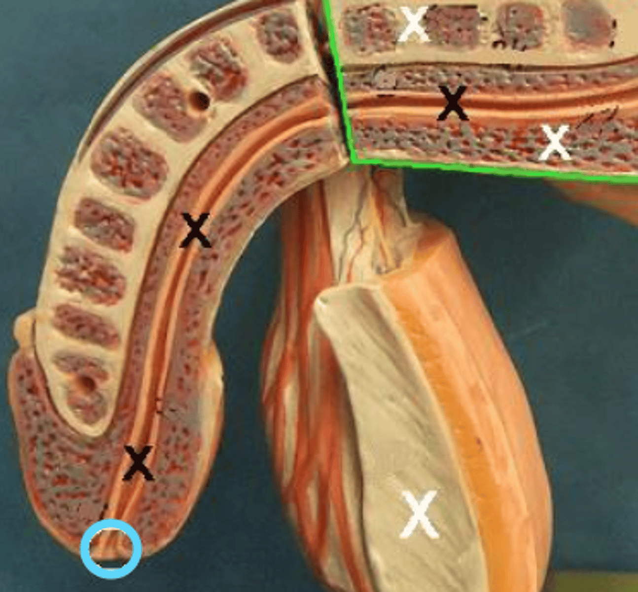 <p>Identify this urinary system structure.</p>