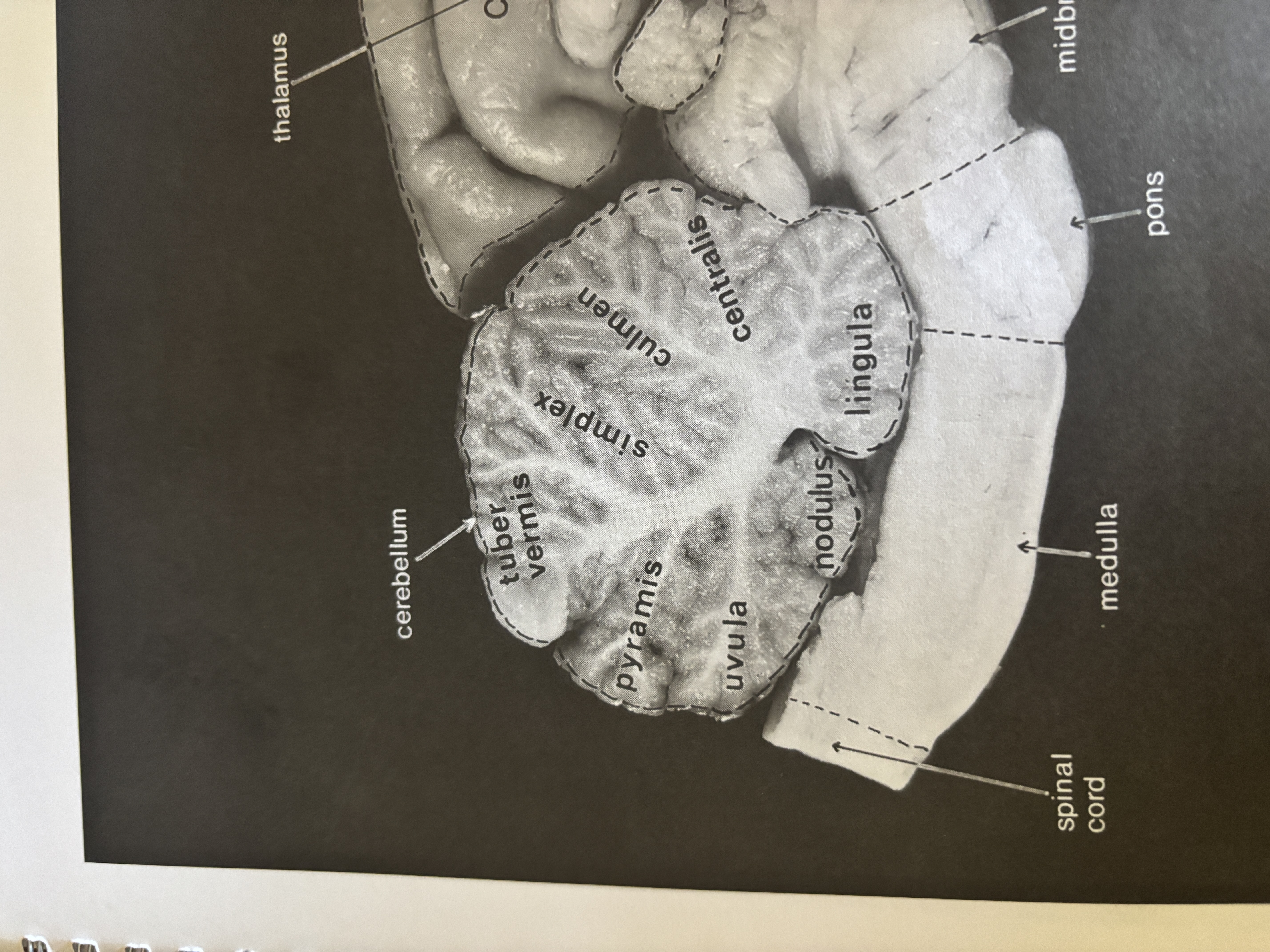 <p>Simplex</p>
