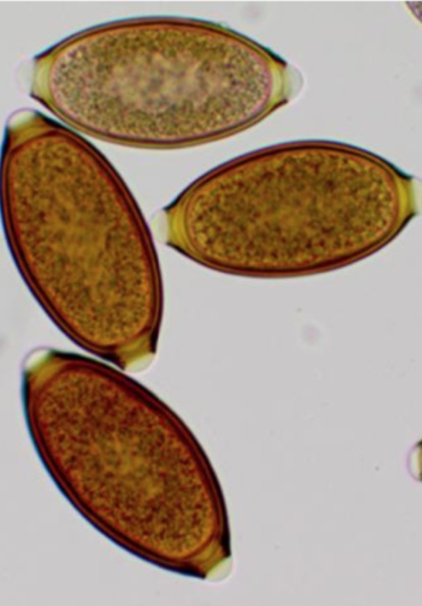 <p>What is the scientific name of these eggs found on this fecal float?</p>