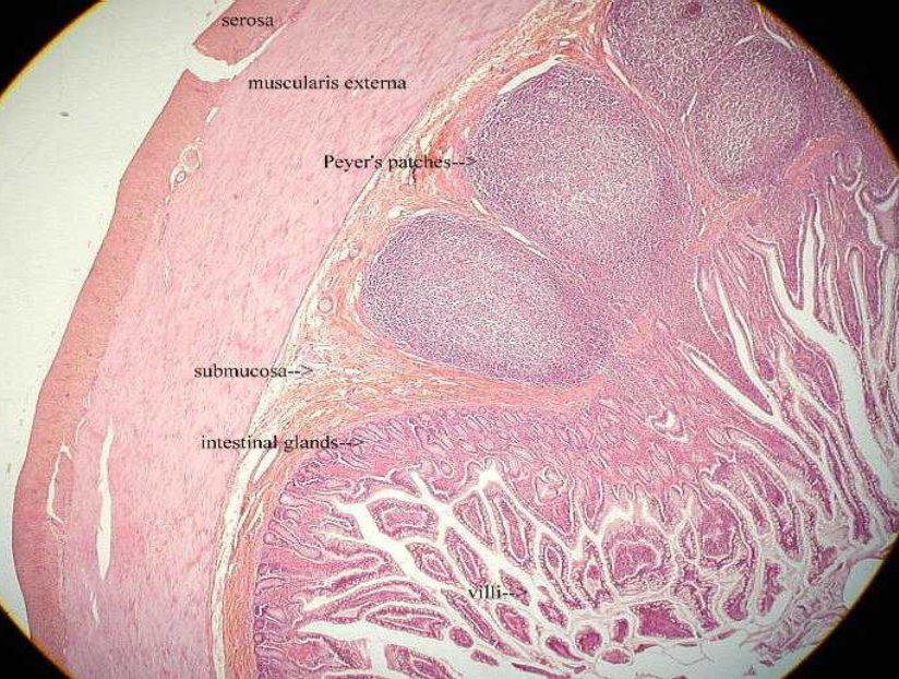 <p>ileum of small intestine</p>
