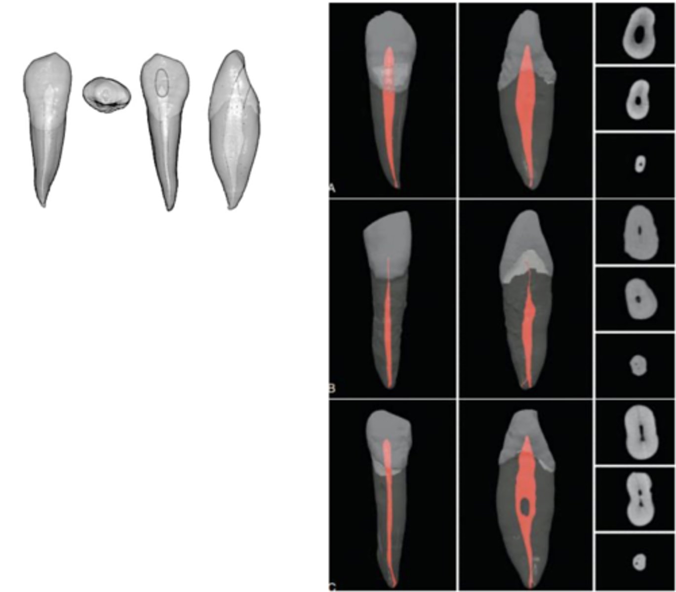 <p>mandibular canine</p>