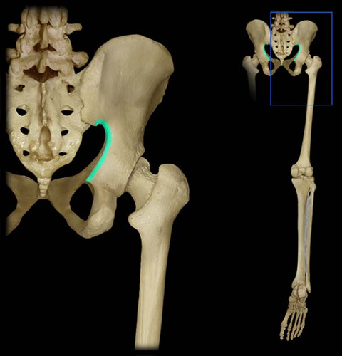 Separates posterior inferior iliac spine from ischial spine
