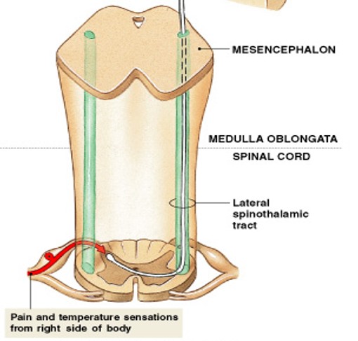 <p>Which tract of&nbsp;anterolateral pathway:</p><ul><li><p>Carries pain and temperature sensations</p></li></ul><p></p>