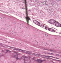 <p>what kind of cartilage is this </p>