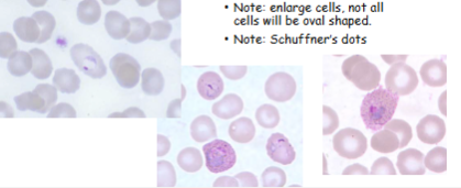 <p>What is the genus, species, and stage of this parasite?</p>