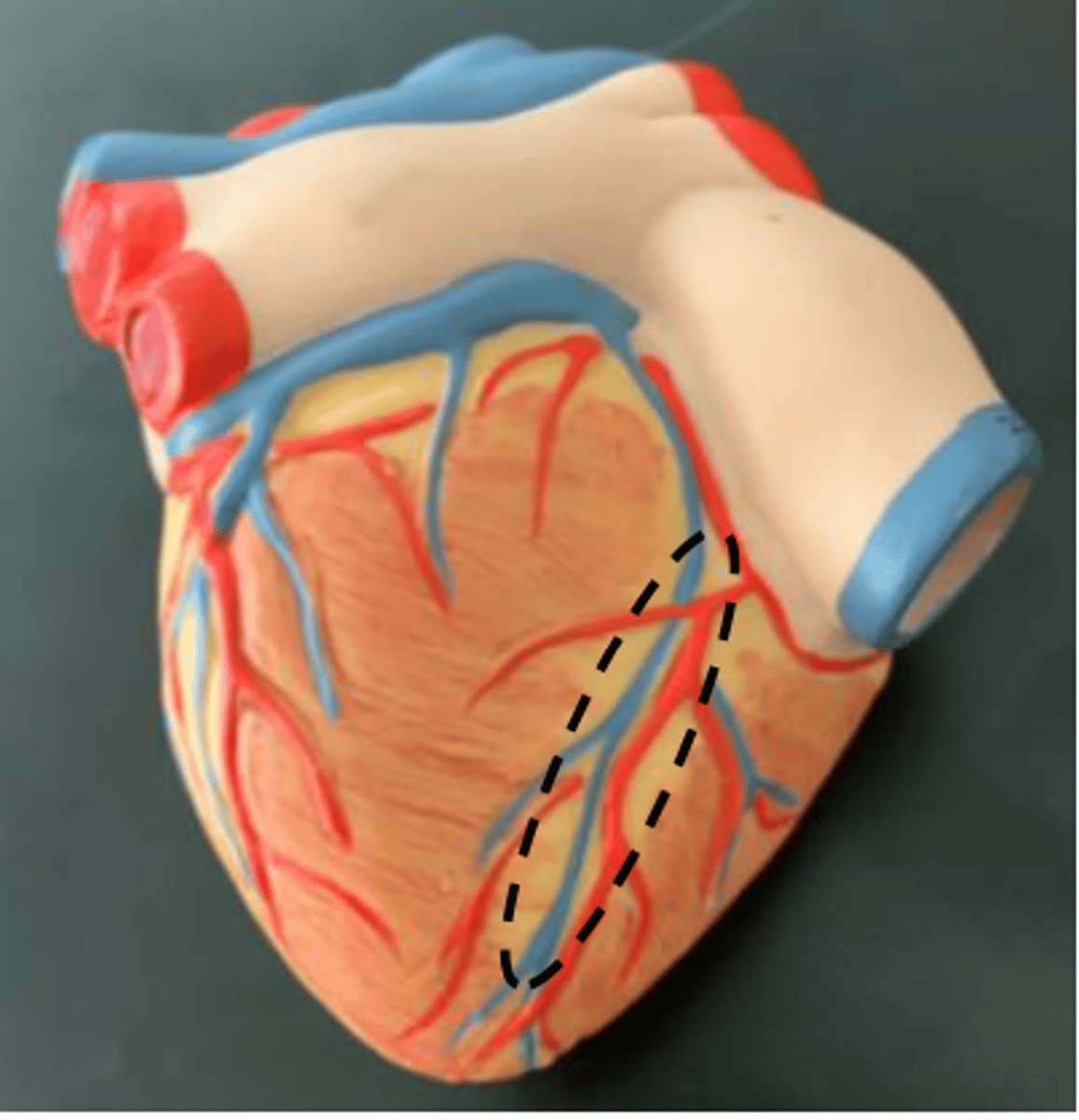 <p>(white groove that separates ventricles on posterior side)</p>