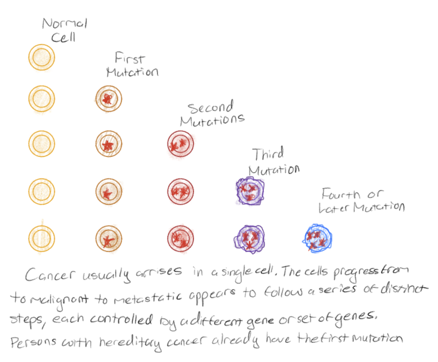<p>The conversion of a normal cell to a cancer cell</p>