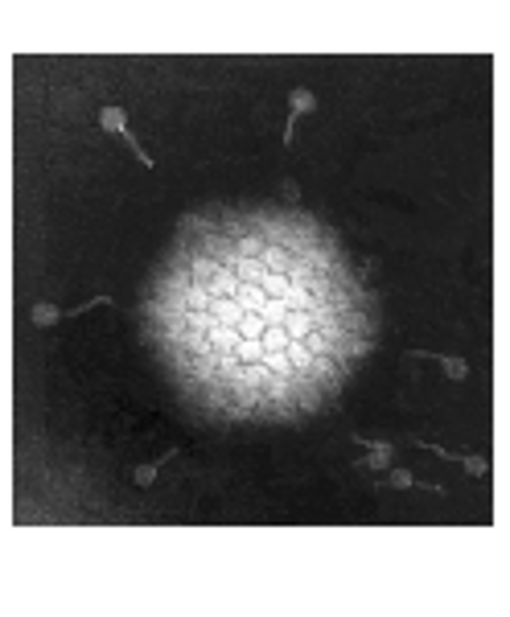 <p>Identify Pathogen causing Diarrhea:</p><p>dsDNA Virus</p><p>-Hx:</p><p>&gt; Children</p><p>-Sx/PE:</p><p>&gt; Watery Diarrhea</p>