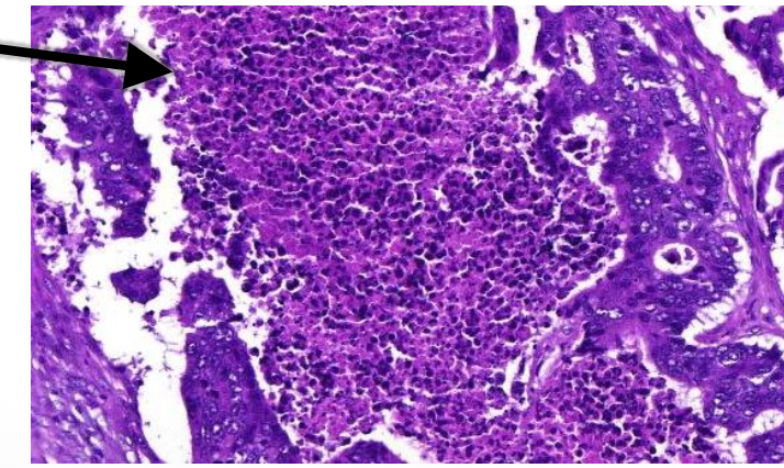 <p>colon/rectum: wat wordt er aangeduid</p>