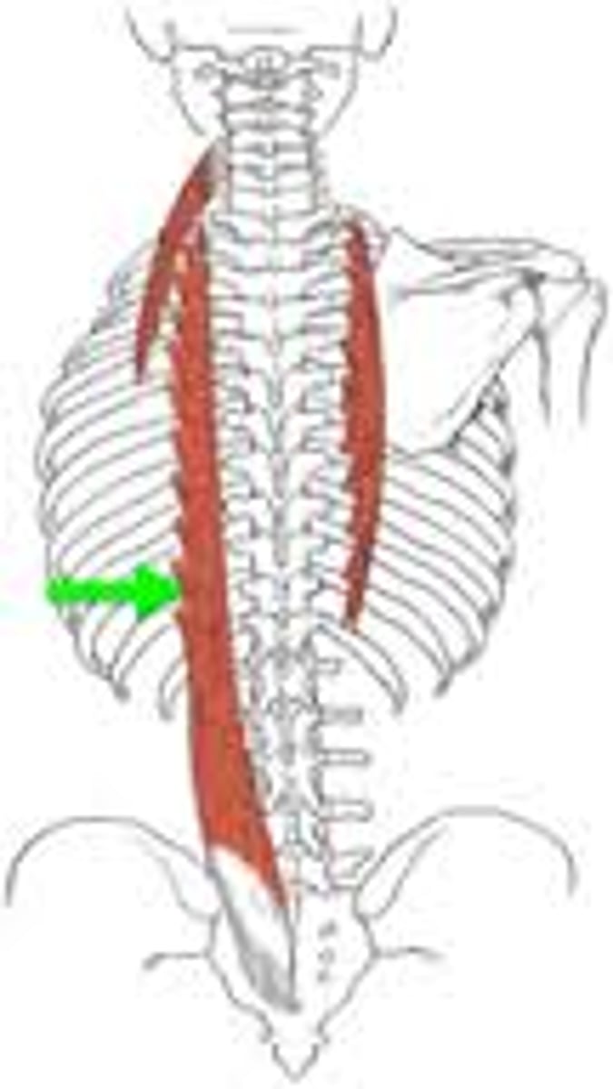 <p>posterior, most lateral</p>