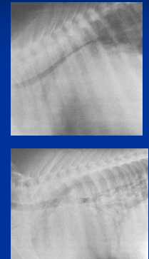 <ul><li><p><span style="color: rgb(136, 136, 136);"><strong>Et: </strong></span><u>poor myocardial&nbsp; ventricular pumping efficiency</u></p><ul><li><p>Myocardial injury/myopathy, Volume overload (<u>valvular insufficiency,</u> High afterload (pulmonary/systemic <u>hypertension</u>), Acute <u>tachyarrhythmias</u> (AF, VT)</p></li></ul></li></ul><ul><li><p><span style="color: rgb(136, 136, 136);"><strong>Types:&nbsp;</strong></span></p><ul><li><p><strong>Left:</strong> pulmonary hypertension/edema, <u>poor systemic arterial circulation</u></p><ul><li><p><span style="color: rgb(136, 136, 136);"><strong>Cs: </strong></span><u>weakness, exercise intolerance, cough, </u>dyspnea, tachycardia, weak pulses</p></li></ul></li><li><p><strong>Right: </strong>systemic venous backup</p><ul><li><p><span style="color: rgb(136, 136, 136);"><strong>Cs:<u> </u></strong></span><u>jugular distention, edema</u></p></li></ul></li></ul></li></ul><ul><li><p><span style="color: rgb(136, 136, 136);"><strong>Dt:</strong></span><strong> </strong><u>murmurs,</u> prerenal <u>azotemia</u>, high hepatic enzymes, high CVP, <strong><u>echo</u></strong><u> w/ chamber enlargement + poor function, </u>rad w/ cardiomegaly + pulmonary edema</p></li><li><p><span style="color: rgb(136, 136, 136);"><strong>Tx: </strong></span>Furosemide (<u>diuretic</u>), Digoxin (<u>positive inotrope</u>), Benazepril (<u>ACE inhibitor</u>)</p></li></ul><p></p>