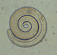 <p>Figure F: _______liberated from bear meat. This larva is from a different case than those shown in Figures A-D</p>