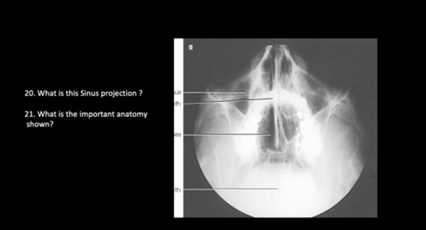 <p>What is the important anatomy shown?</p>