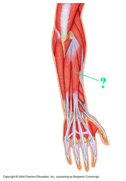 <p><span>Identify the indicated muscle</span></p>