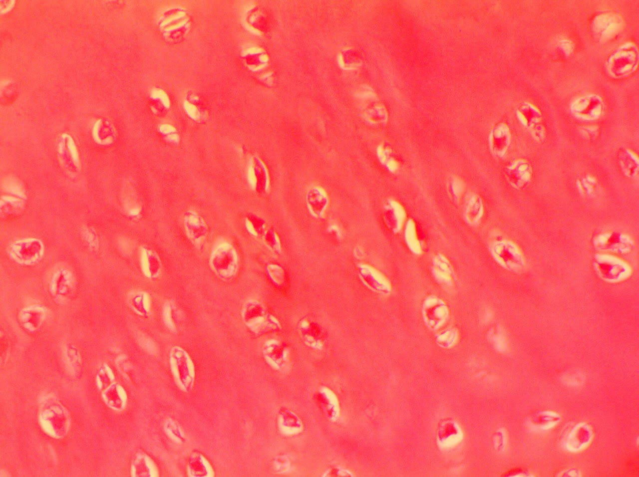 <p><span>Most abundant cartilage</span></p><p class="zfr3Q CDt4Ke "><span>Located in areas such as the ends of long bones</span></p>