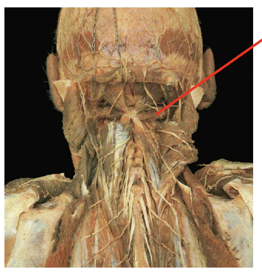 <p>What is this muscle&nbsp;What is its origin. Where does it inserts. </p>
