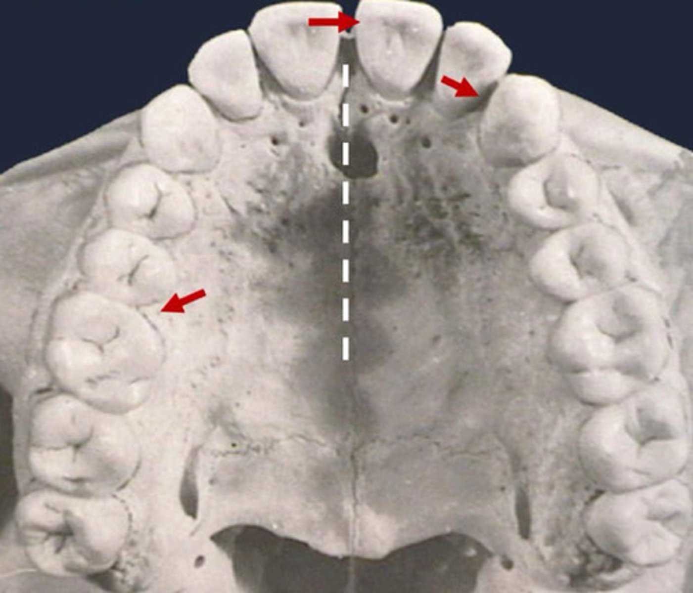 <p>Is the surface of the tooth nearest to the midline of dental arch</p>