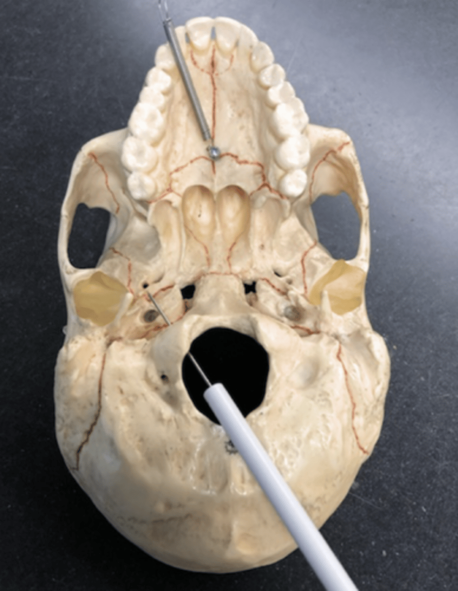 <p>Goes through the occipital condyles</p>
