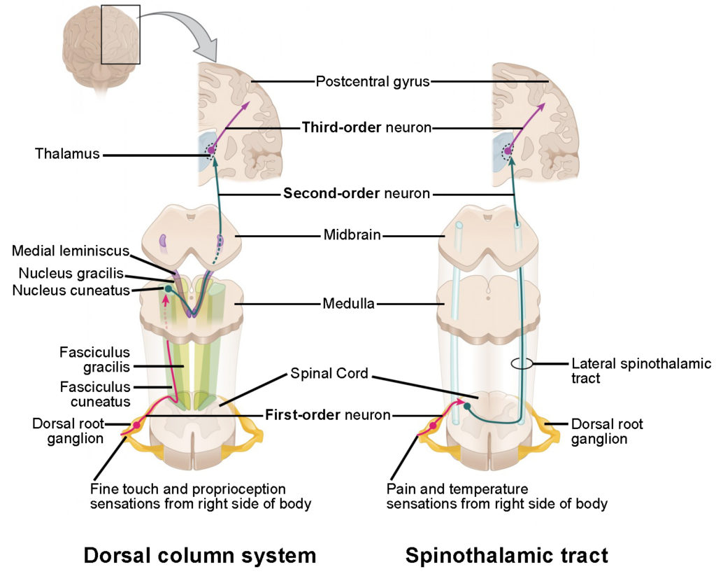 <p><strong>1. Receptors (Feel it)</strong> </p><ul><li><p class=""><strong>Mechanoreceptors</strong> in the skin detect crude touch/pressure.</p></li><li><p class="">Signals travel via <strong>Aδ and C fibers</strong> (slower than dorsal column fibers).</p></li></ul><p> </p><p> <strong>2. First-Order Neurons (Enter spinal cord)</strong> </p><ul><li><p class="">Enter via the <strong>dorsal root</strong> of the spinal cord.</p></li><li><p class="">Synapse <strong>immediately</strong> in the <strong>dorsal horn</strong> (unlike dorsal column where they ascend first).</p></li></ul><p> </p><p> <strong>3. Second-Order Neurons (Cross it)</strong> </p><ul><li><p class="">After synapsing, these neurons <strong>decussate</strong> (cross over) in the spinal cord (usually within 1–2 segments).</p></li><li><p class="">They then ascend <strong>contralaterally</strong> in the <strong>ventral (anterior) funiculus</strong> as the <strong>ventral spinothalamic tract</strong>.</p></li></ul><p> </p><p> <strong>4. Thalamus (Relay station)</strong> </p><ul><li><p class="">The tract ascends to the <strong>ventral posterolateral nucleus (VPL)</strong> of the <strong>thalamus</strong>.</p></li><li><p class="">Still somatotopically organized: lower body more lateral, upper body more medial (opposite of cortex layout).</p></li></ul><p> </p><p> <strong>5. Third-Order Neurons (To the brain!)</strong> </p><ul><li><p class="">From the thalamus, third-order neurons project to the <strong>primary somatosensory cortex</strong> in the <strong>postcentral gyrus</strong>.</p></li></ul><p></p>