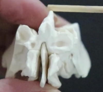 <p>fish fin that sticks out into the skull</p>