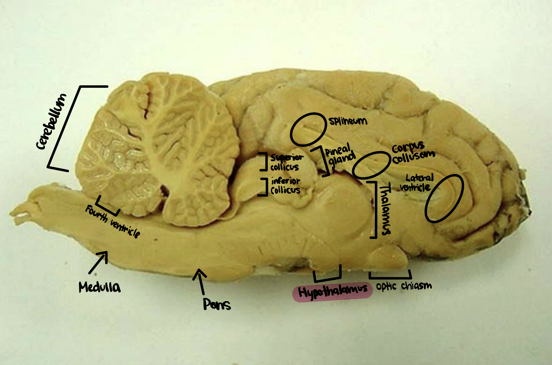 <p>Hypothalamus</p>
