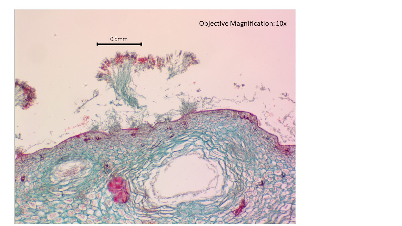 <p>Ascomycota&nbsp;</p>