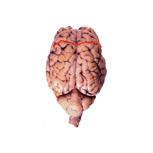 <p>Separates the parietal lobe from the frontal lobe, and the primary motor cortex from the primary somatosensory cortex</p>