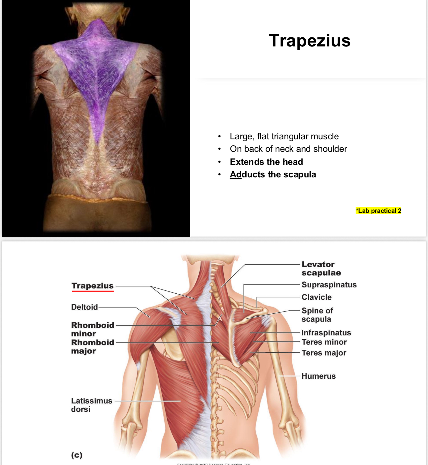 <p>Muscle that assists with neck extension and scapula adduction.</p>