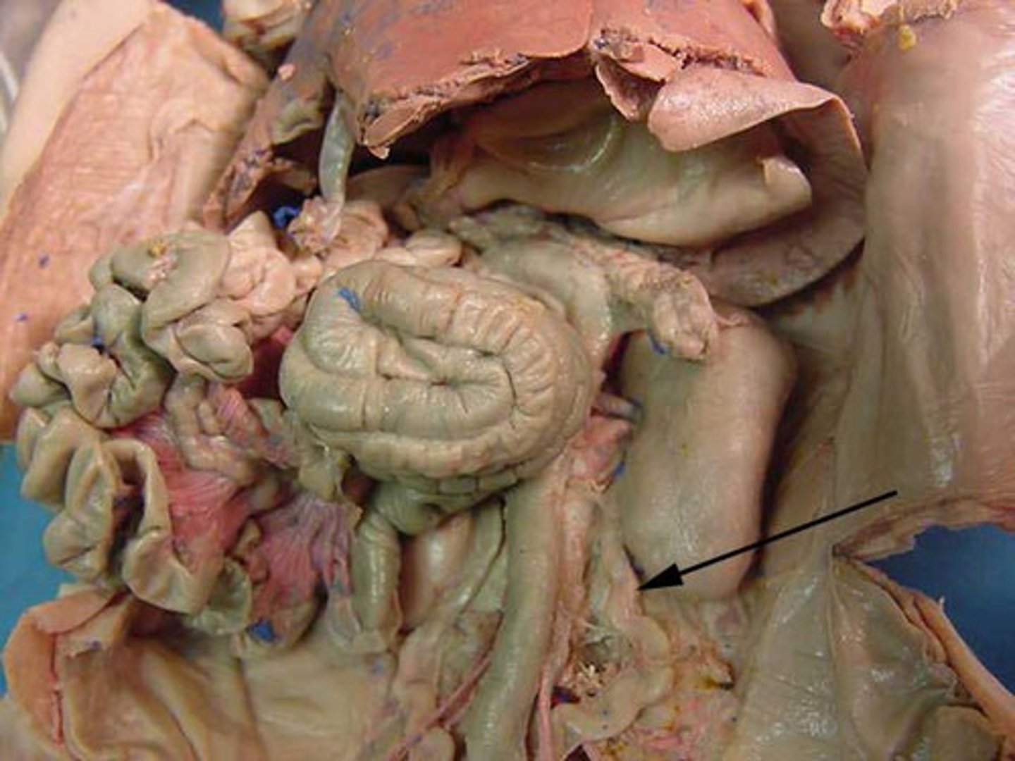 <p>duct leading from the kidney to the urinary bladder</p>