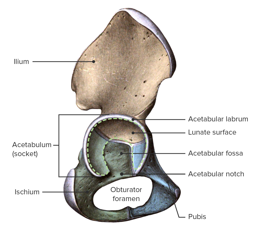 <p>Acetabular Labrum</p>