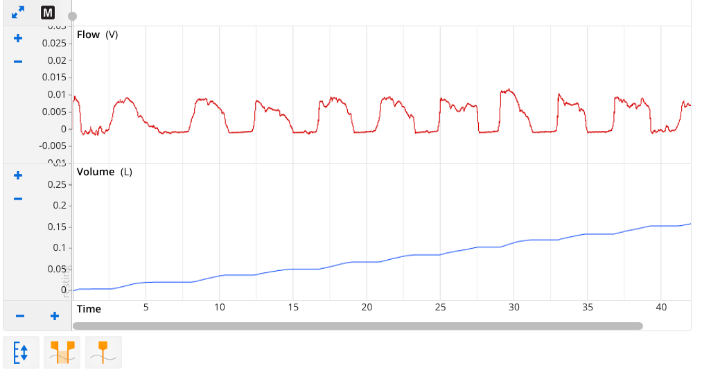 <p>pneumotachometer/Spirometry</p><p>blue = ?</p><p></p>