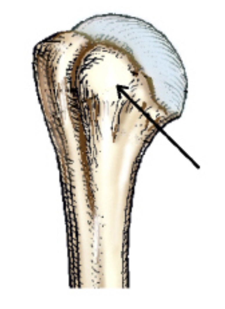 <p>The small, rounded, elevated process identified by the arrow in this figure is the:</p>