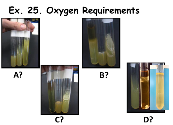 <p><strong>Oxygen Requirements - </strong>Guess the following.</p>