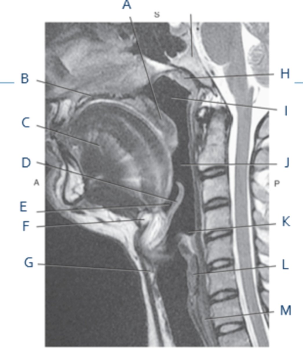 <p>Label M</p>