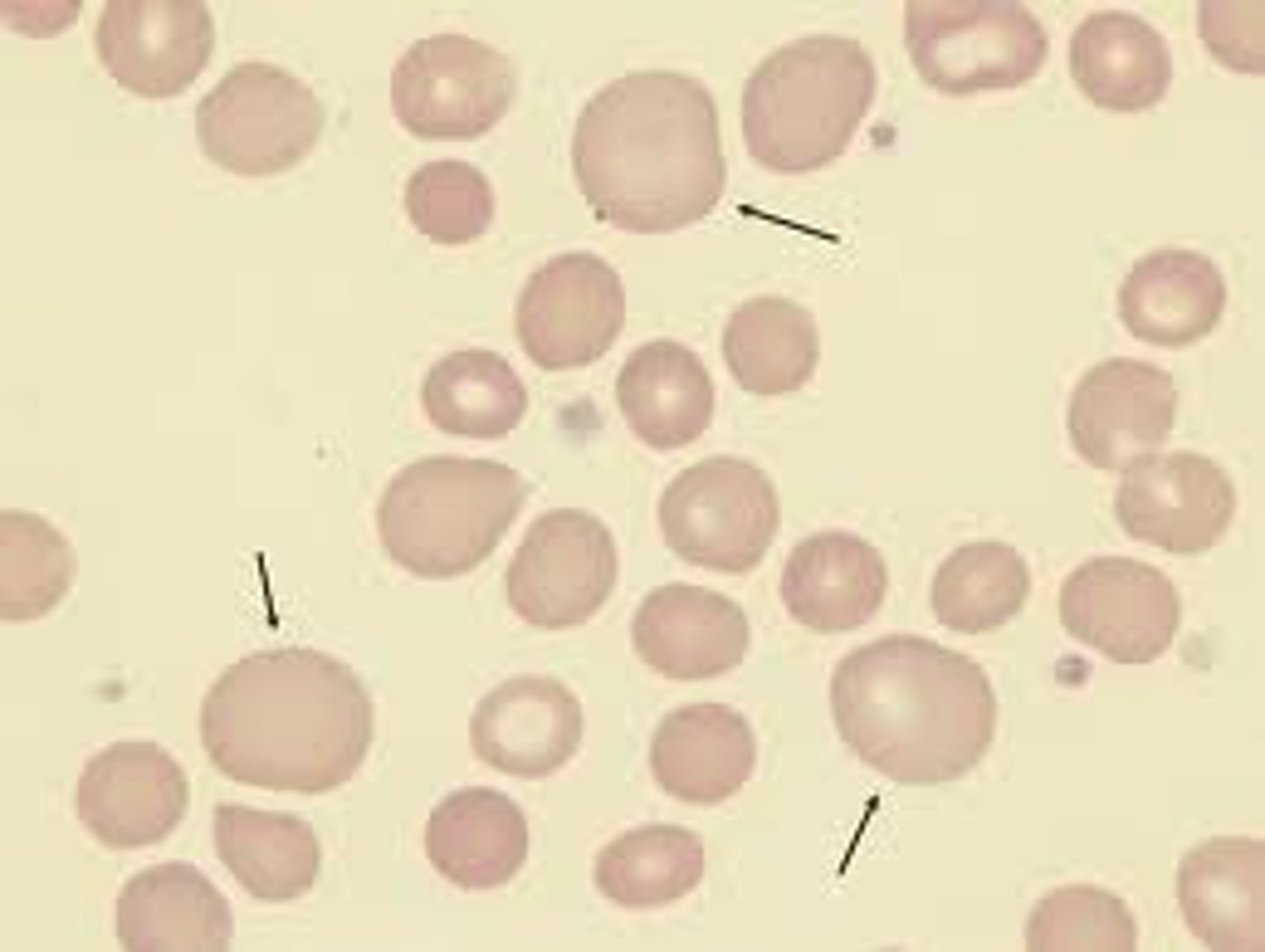 <p>increased RBC size</p>