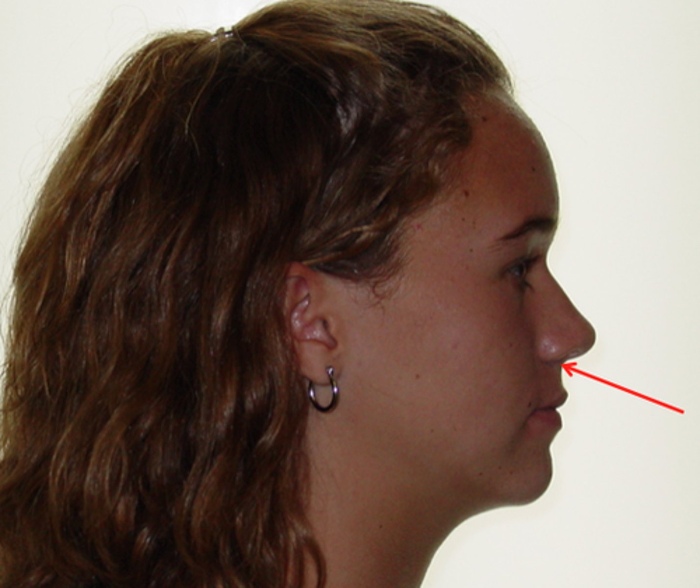 <p>What structure does this point out?</p>