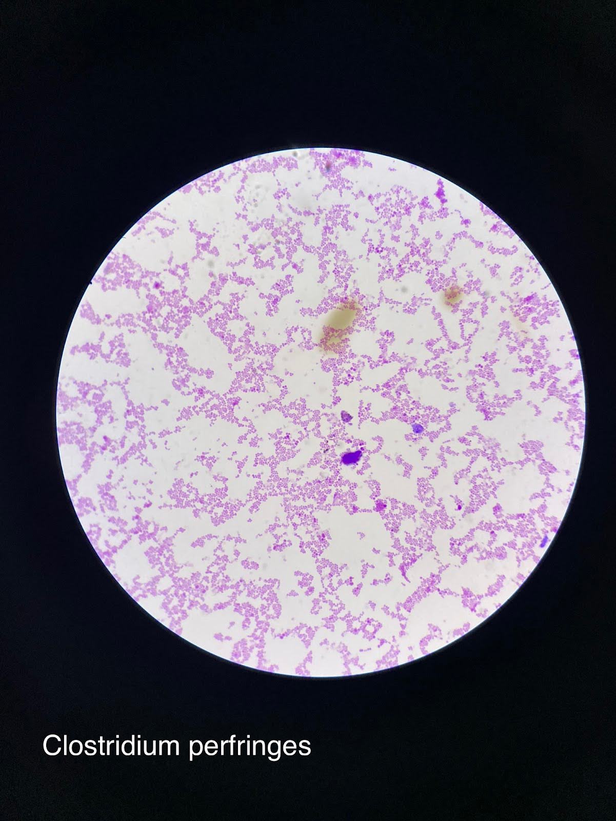 <p><em>Clostridium perfringens</em></p><ul><li><p>Rod-shaped (bacilli)</p></li><li><p>Arrangement: Single or in short chains</p></li><li><p>Size: 3.0 to 8.0 micrometers</p></li><li><p>Gram Stain Color: Purple or blue (Gram-positive)</p></li><li><p>providing agroecological benefits in plant-growth promotion</p></li></ul><p></p>