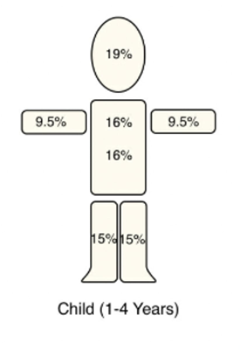 <p>The child's head is 19% of TBSA (9.5% front + 9.5% back)</p><p>As a general rule, for every year >1 y/o up to 10 y/o, you can ↓ head SA by 1% + ↑ each leg by 0.5%</p>