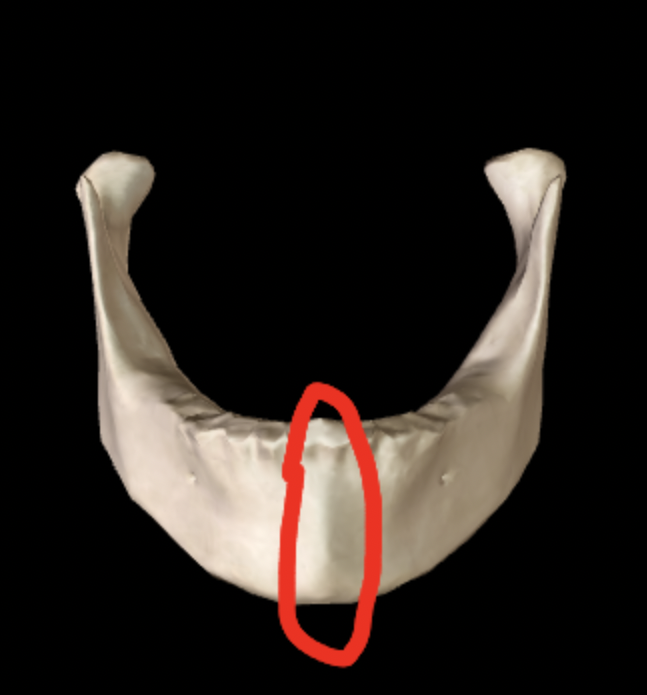 <p>What part of the mandible is this?</p>