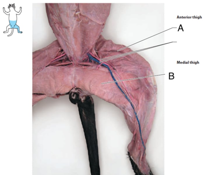 <p>What is the muscle indicated by letter B?</p>