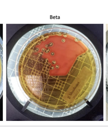 <p><span><span>Beta (β) hemolysis</span></span></p>