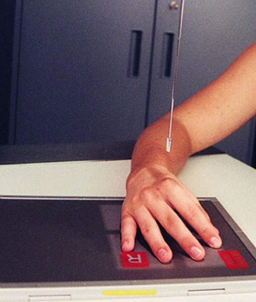 <p>PA oblique (hand)</p>