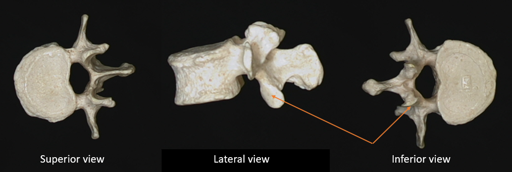 inferior articulating facet 